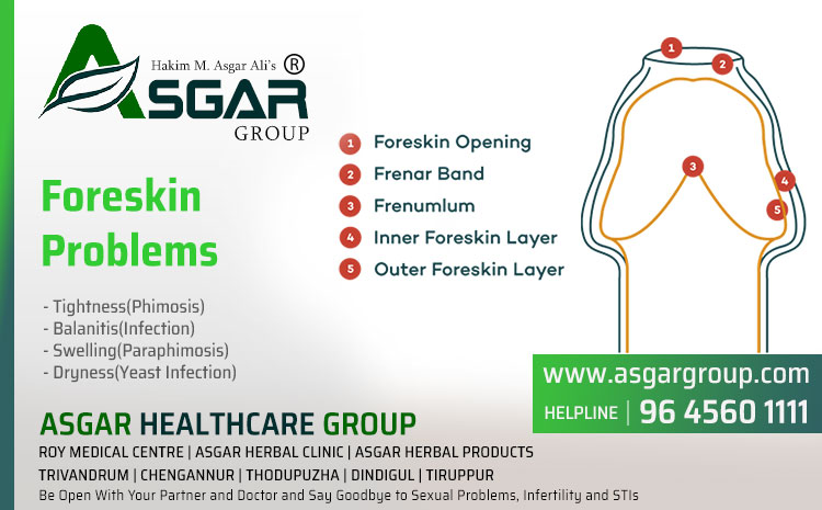 Foreskin-Problems-Tightness-Phimosis-Balanitis-Swelling-Paraphimosis-Dryness