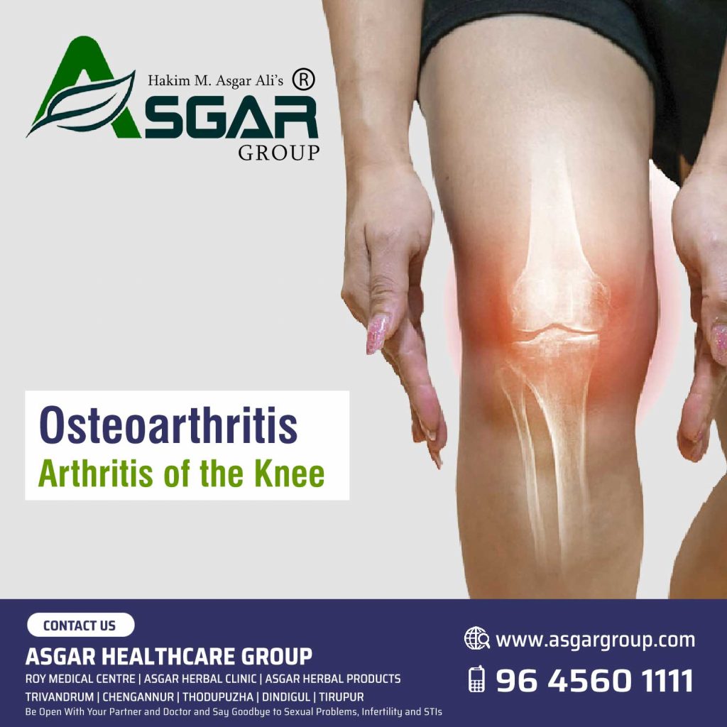Osteoarthritis-Arthritis-of-the-Knee