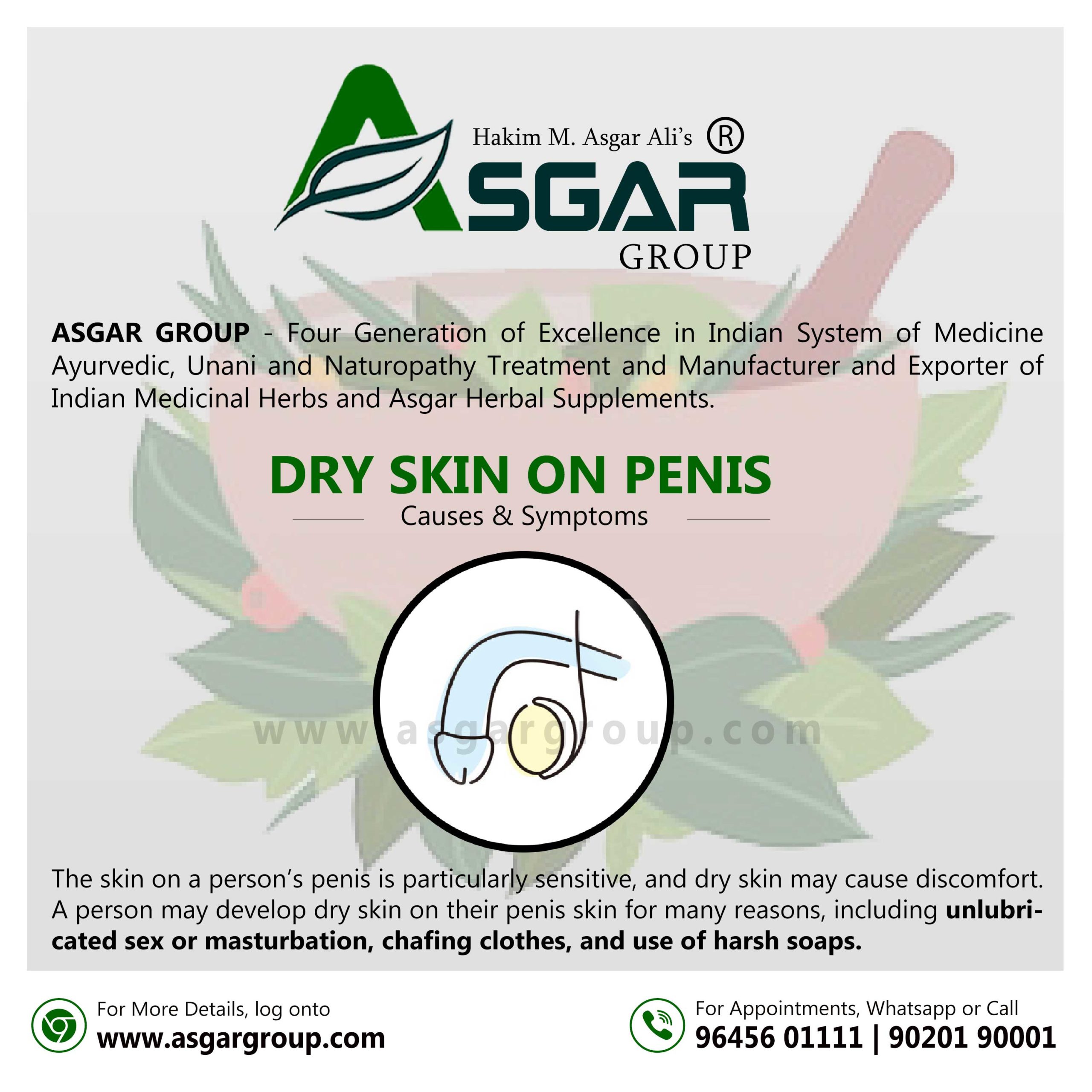 Dry Penis Skin and sexually transmitted infection Treatment Roy Medical Centre Kerala Asgar Herbal Group India scaled