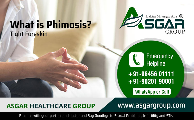 Phimosis (Tight Foreskin) - Causes, Symptoms, Treatments