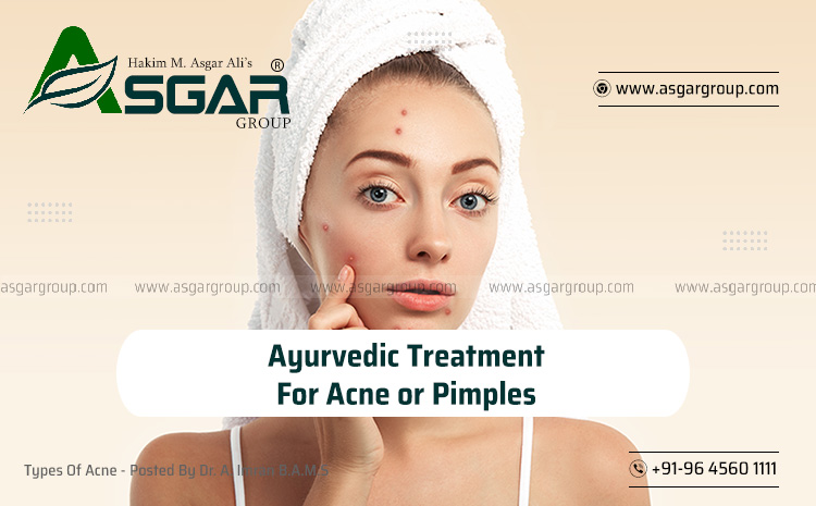  Ayurvedic Treatment For Acne