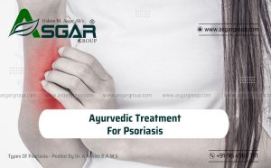 Ayurvedic-Treatment-For-Psoriasis-Roy-Medical-Centre-Kerala-Asgar-Healthcare-Group-Tirupur-TamiASGAR-GROUP