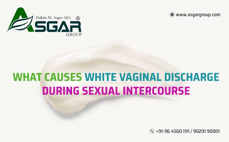  What Causes White Vaginal Discharge During Sexual Intercourse